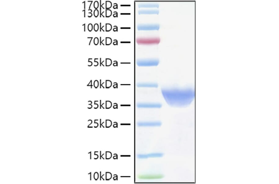 SDS-PAGE - Recombinant Human FOLR1 Protein (C-terminal His Tag) (A330668) - Antibodies.com