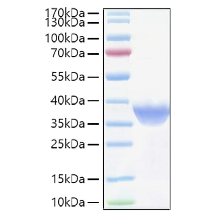 SDS-PAGE - Recombinant Human FOLR1 Protein (C-terminal His Tag) (A330668) - Antibodies.com