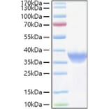 SDS-PAGE - Recombinant Human FOLR1 Protein (C-terminal His Tag) (A330668) - Antibodies.com