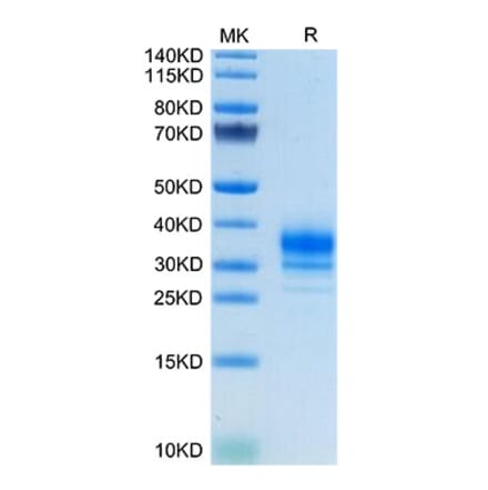 Tris-Bis PAGE - Recombinant Human FOLR2 Protein (C-terminal His Tag) (A330669) - Antibodies.com