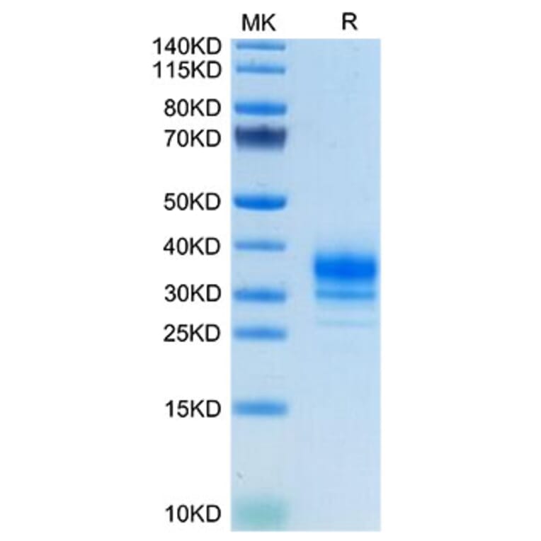 Tris-Bis PAGE - Recombinant Human FOLR2 Protein (C-terminal His Tag) (A330669) - Antibodies.com