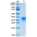 Tris-Bis PAGE - Recombinant Human FOLR2 Protein (C-terminal His Tag) (A330669) - Antibodies.com