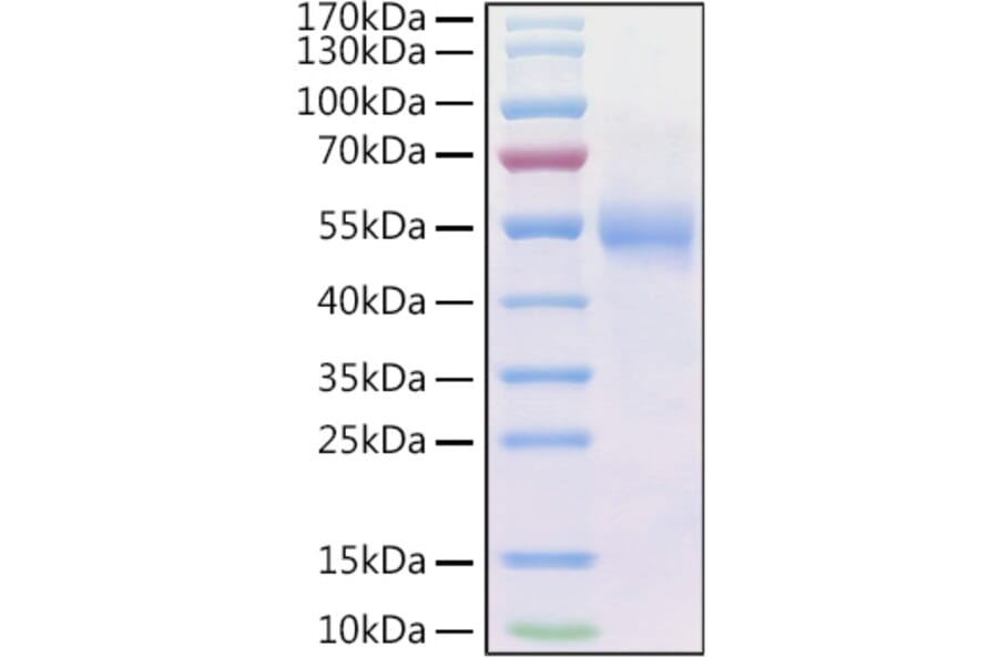 SDS-PAGE - Recombinant Human Frizzled 2/FZD2 Protein (C-terminal Human Fc and His Tag) (A330670) - Antibodies.com