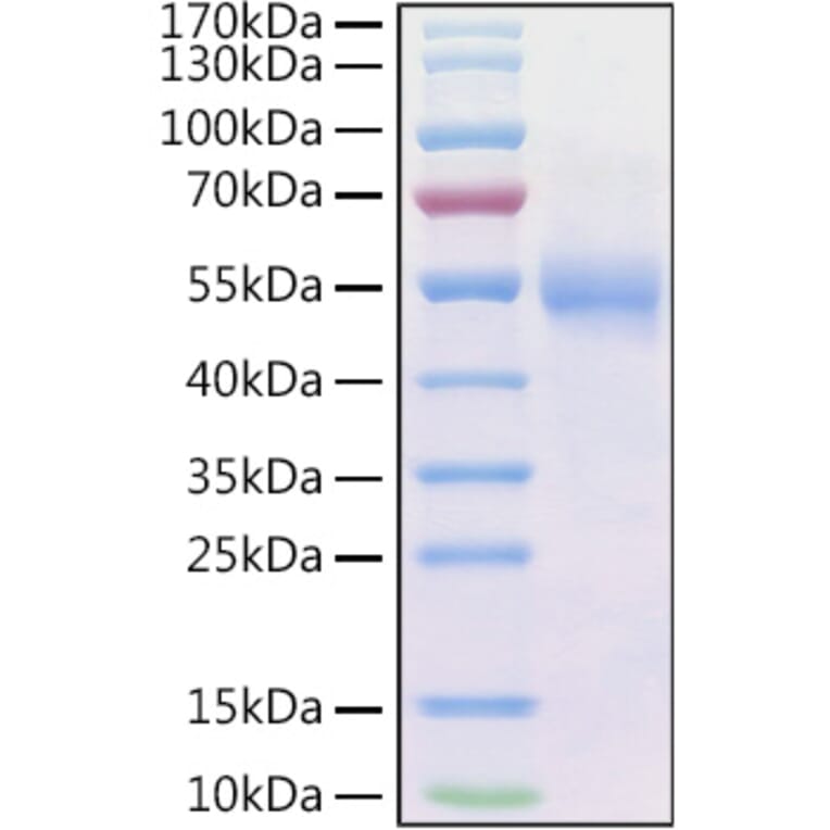 SDS-PAGE - Recombinant Human Frizzled 2/FZD2 Protein (C-terminal Human Fc and His Tag) (A330670) - Antibodies.com