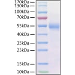 SDS-PAGE - Recombinant Human Frizzled 2/FZD2 Protein (C-terminal Human Fc and His Tag) (A330670) - Antibodies.com