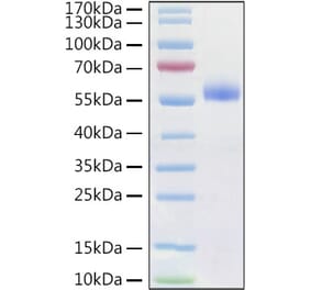 SDS-PAGE - Recombinant Human Frizzled 4 Protein (C-terminal Human Fc and His Tag) (A330671) - Antibodies.com