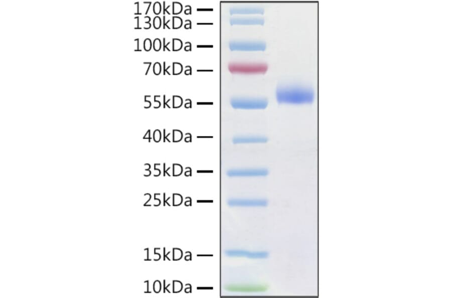 SDS-PAGE - Recombinant Human Frizzled 4 Protein (C-terminal Human Fc and His Tag) (A330671) - Antibodies.com