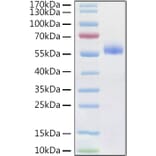 SDS-PAGE - Recombinant Human Frizzled 4 Protein (C-terminal Human Fc and His Tag) (A330671) - Antibodies.com