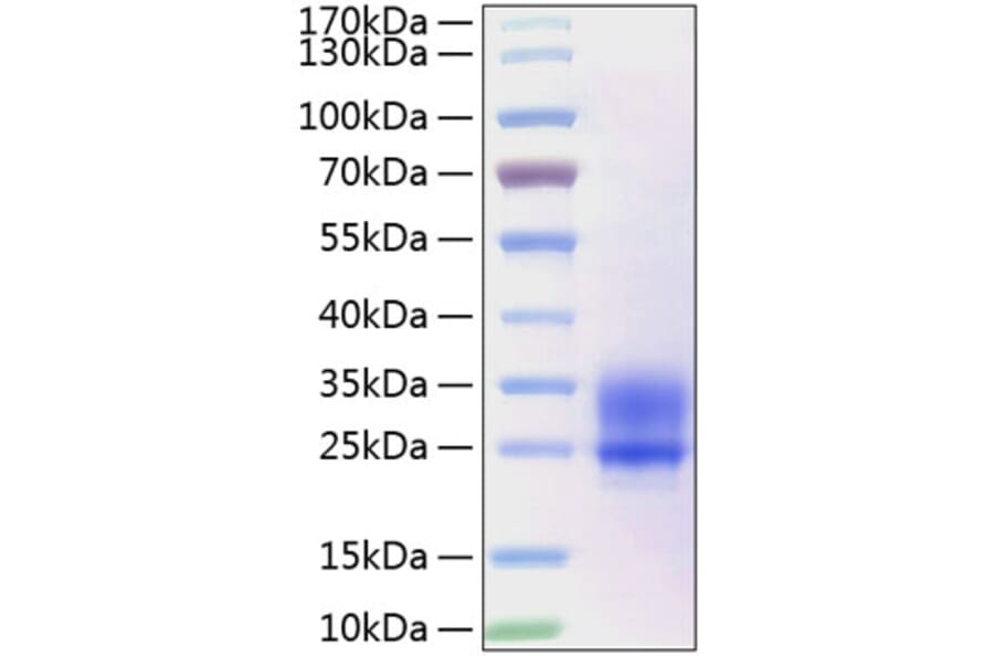 SDS-PAGE - Recombinant Human Frizzled 5 Protein (C-terminal His Tag) (A330672) - Antibodies.com