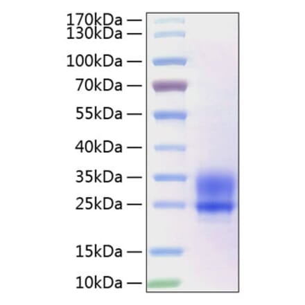SDS-PAGE - Recombinant Human Frizzled 5 Protein (C-terminal His Tag) (A330672) - Antibodies.com