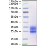 SDS-PAGE - Recombinant Human Frizzled 5 Protein (C-terminal His Tag) (A330672) - Antibodies.com