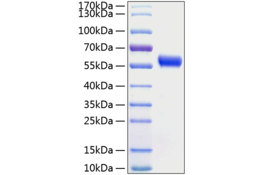 SDS-PAGE - Recombinant Human Frizzled 5 Protein (C-terminal Human Fc and His Tag) (A330673) - Antibodies.com