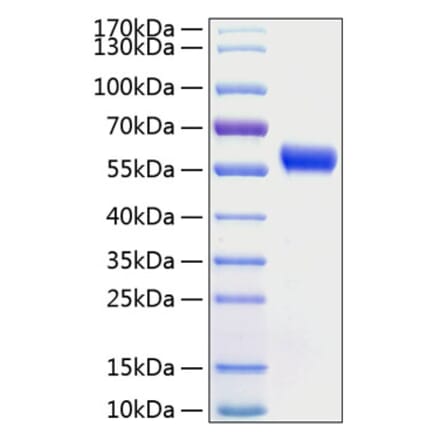 SDS-PAGE - Recombinant Human Frizzled 5 Protein (C-terminal Human Fc and His Tag) (A330673) - Antibodies.com