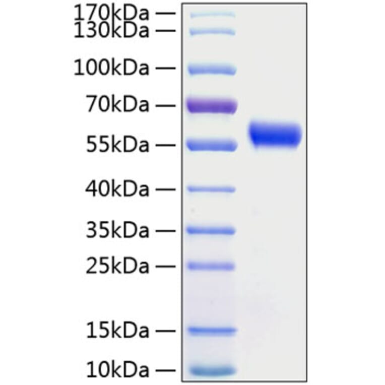 SDS-PAGE - Recombinant Human Frizzled 5 Protein (C-terminal Human Fc and His Tag) (A330673) - Antibodies.com
