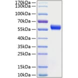 SDS-PAGE - Recombinant Human Frizzled 5 Protein (C-terminal Human Fc and His Tag) (A330673) - Antibodies.com