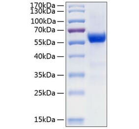 SDS-PAGE - Recombinant Human Frizzled 7 Protein (C-terminal Human Fc and His Tag) (A330674) - Antibodies.com