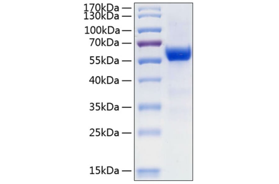 SDS-PAGE - Recombinant Human Frizzled 7 Protein (C-terminal Human Fc and His Tag) (A330674) - Antibodies.com