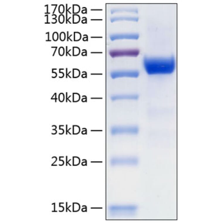 SDS-PAGE - Recombinant Human Frizzled 7 Protein (C-terminal Human Fc and His Tag) (A330674) - Antibodies.com
