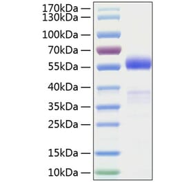 SDS-PAGE - Recombinant Human Frizzled homolog 1 Protein (C-terminal Human Fc and His Tag) (A330675) - Antibodies.com