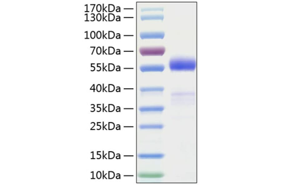 SDS-PAGE - Recombinant Human Frizzled homolog 1 Protein (C-terminal Human Fc and His Tag) (A330675) - Antibodies.com