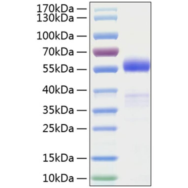 SDS-PAGE - Recombinant Human Frizzled homolog 1 Protein (C-terminal Human Fc and His Tag) (A330675) - Antibodies.com