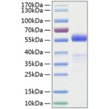 SDS-PAGE - Recombinant Human Frizzled homolog 1 Protein (C-terminal Human Fc and His Tag) (A330675) - Antibodies.com
