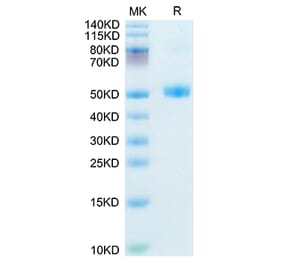 SDS-PAGE - Recombinant Mouse FSH beta Protein (C-terminal Human Fc Tag) (A330676) - Antibodies.com