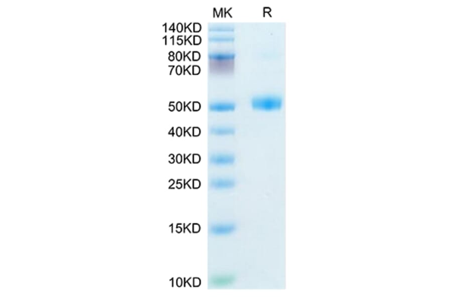 SDS-PAGE - Recombinant Mouse FSH beta Protein (C-terminal Human Fc Tag) (A330676) - Antibodies.com