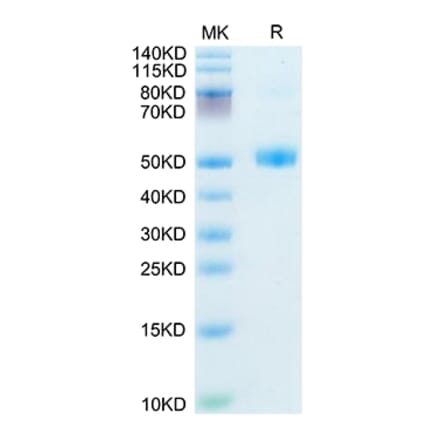SDS-PAGE - Recombinant Mouse FSH beta Protein (C-terminal Human Fc Tag) (A330676) - Antibodies.com