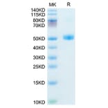 SDS-PAGE - Recombinant Mouse FSH beta Protein (C-terminal Human Fc Tag) (A330676) - Antibodies.com
