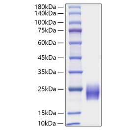 SDS-PAGE - Recombinant Human FSH beta Protein (C-terminal His Tag) (A330677) - Antibodies.com