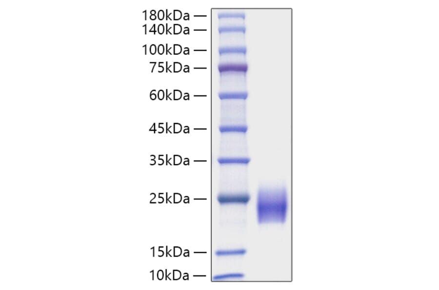 SDS-PAGE - Recombinant Human FSH beta Protein (C-terminal His Tag) (A330677) - Antibodies.com