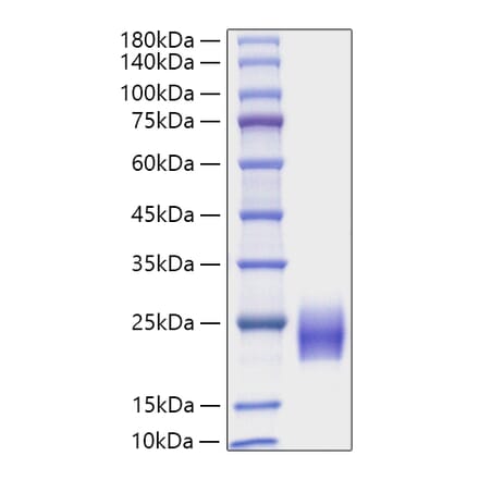SDS-PAGE - Recombinant Human FSH beta Protein (C-terminal His Tag) (A330677) - Antibodies.com