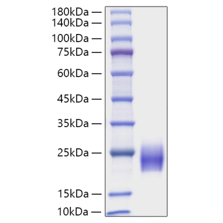 SDS-PAGE - Recombinant Human FSH beta Protein (C-terminal His Tag) (A330677) - Antibodies.com