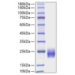 SDS-PAGE - Recombinant Human FSH beta Protein (C-terminal His Tag) (A330677) - Antibodies.com
