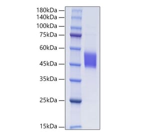 SDS-PAGE - Recombinant Human FSTL1 Protein (C-terminal His Tag) (A330678) - Antibodies.com