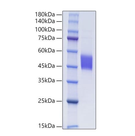 SDS-PAGE - Recombinant Human FSTL1 Protein (C-terminal His Tag) (A330678) - Antibodies.com