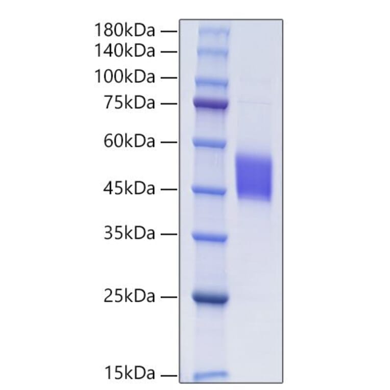 SDS-PAGE - Recombinant Human FSTL1 Protein (C-terminal His Tag) (A330678) - Antibodies.com