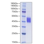 SDS-PAGE - Recombinant Human FSTL1 Protein (C-terminal His Tag) (A330678) - Antibodies.com