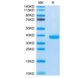 SDS-PAGE - Recombinant Mouse FSTL3 Protein (C-terminal His Tag) (A330679) - Antibodies.com