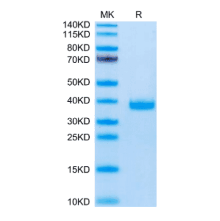 SDS-PAGE - Recombinant Mouse FSTL3 Protein (C-terminal His Tag) (A330679) - Antibodies.com