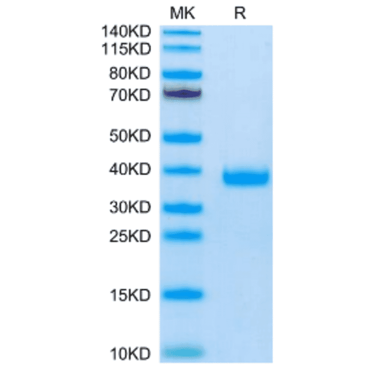 SDS-PAGE - Recombinant Mouse FSTL3 Protein (C-terminal His Tag) (A330679) - Antibodies.com