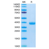 SDS-PAGE - Recombinant Mouse FSTL3 Protein (C-terminal His Tag) (A330679) - Antibodies.com
