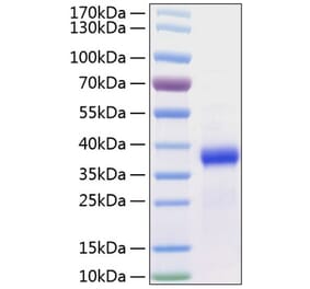 SDS-PAGE - Recombinant Human FSTL3 Protein (C-terminal His Tag) (A330680) - Antibodies.com