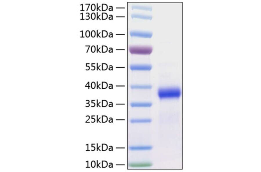 SDS-PAGE - Recombinant Human FSTL3 Protein (C-terminal His Tag) (A330680) - Antibodies.com