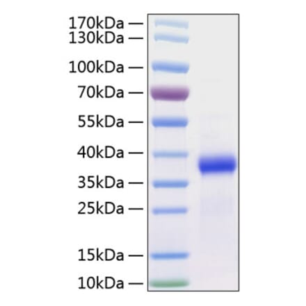 SDS-PAGE - Recombinant Human FSTL3 Protein (C-terminal His Tag) (A330680) - Antibodies.com