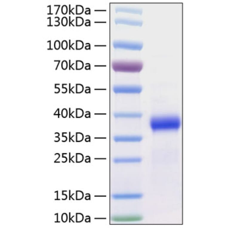 SDS-PAGE - Recombinant Human FSTL3 Protein (C-terminal His Tag) (A330680) - Antibodies.com