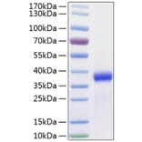 SDS-PAGE - Recombinant Human FSTL3 Protein (C-terminal His Tag) (A330680) - Antibodies.com