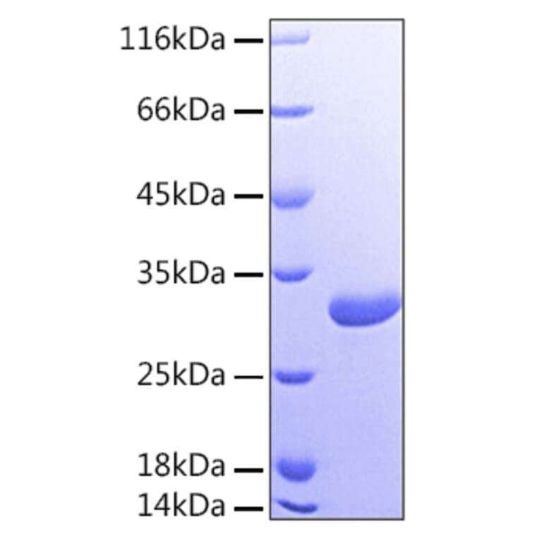 SDS-PAGE - Recombinant Human Galectin 3 Protein (A330682) - Antibodies.com