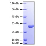 SDS-PAGE - Recombinant Human Galectin 3 Protein (A330682) - Antibodies.com